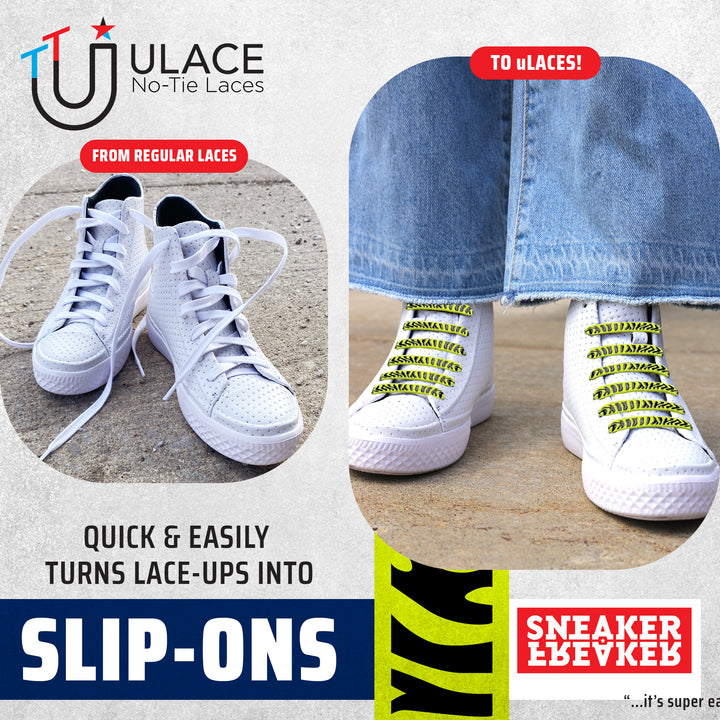 U-Lace Siliprint - Neon Yellow Zebra